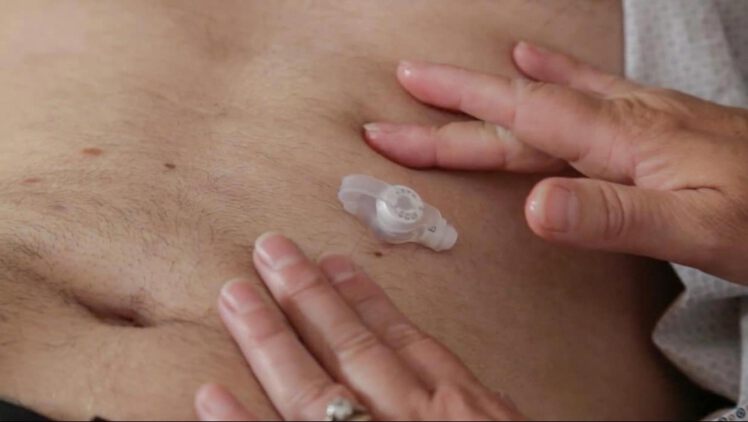 قیمت پگ دکمه ای 