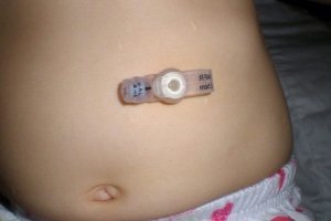 پگ دکمه ای - پگ دکمه ای دانیومد 