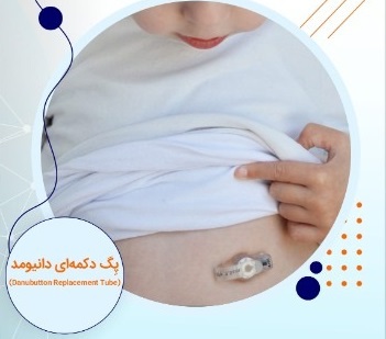 خرید پگ دکمه ای 