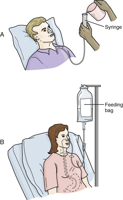 گاواژ چیست ؟